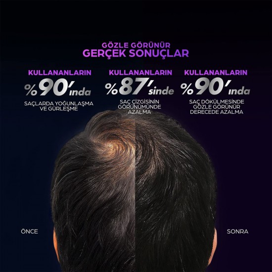 Clear Men Scalp Pro Saç Dökülmesine Karşı Güçlendirici Serum 70 Ml